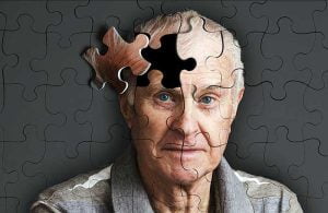 درمان آلزایمر با نقشه برداری مغز 