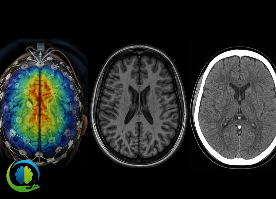 مقایسه نقشه مغزی با MRI